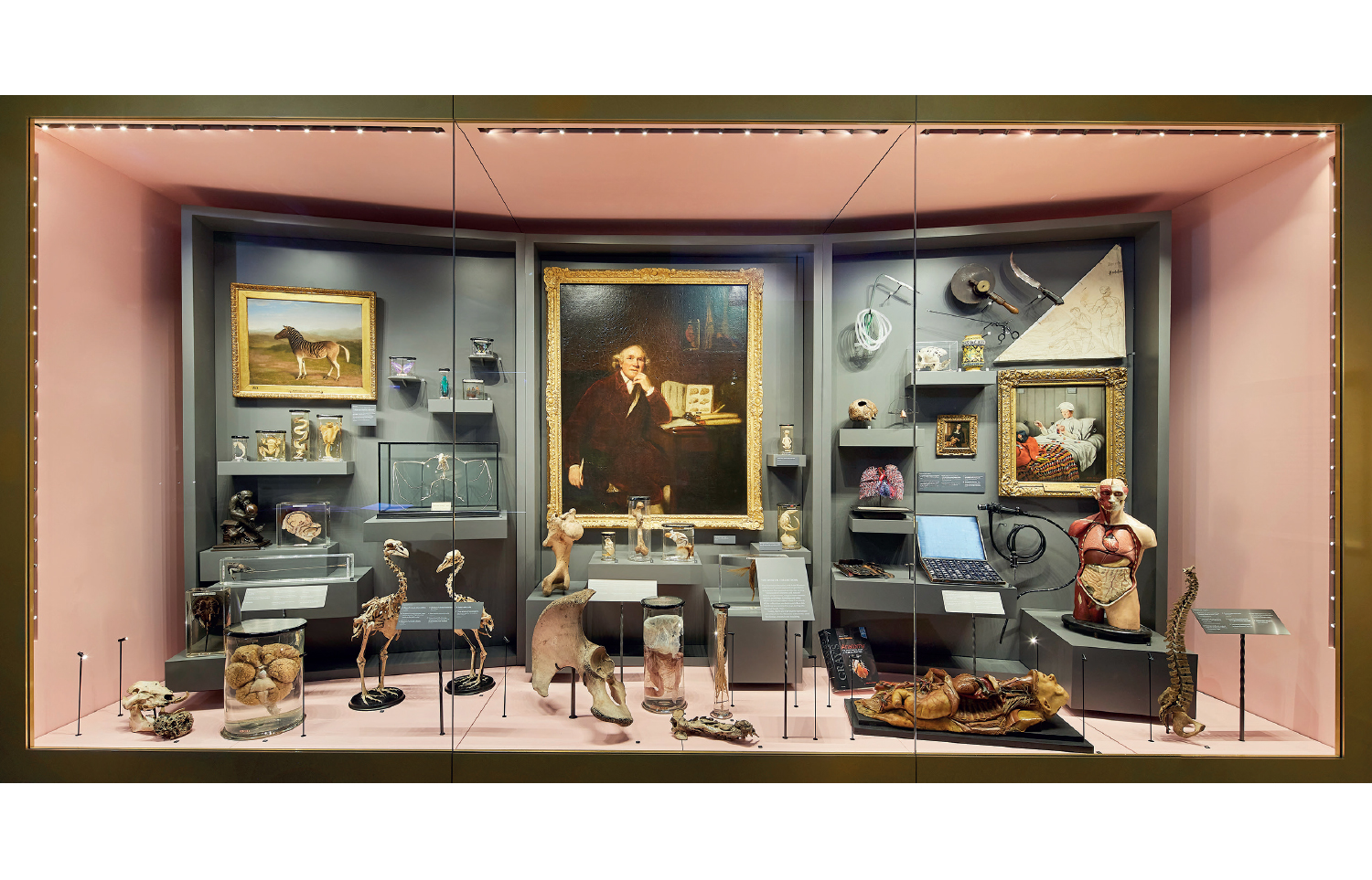 Are surgical museums such as the Hunterian doomed?