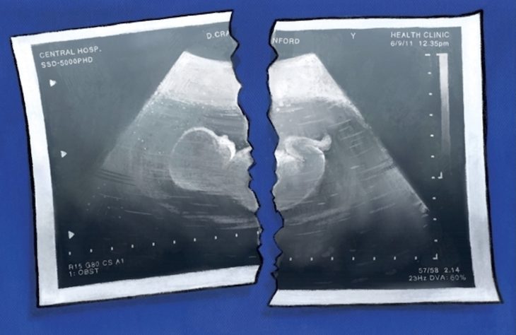 Is forced adoption any more barbaric than abortion?
